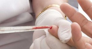 Em Araraquara a Saúde intensifica ações de testagem para hepatite C Hepatite 10