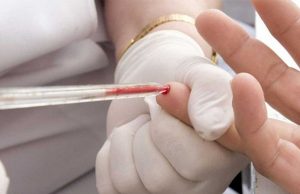 Em Araraquara a Saúde intensifica ações de testagem para hepatite C Hepatite 10