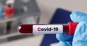 Araraquara registra 60 novos casos de covid-19 nesta terça-feira