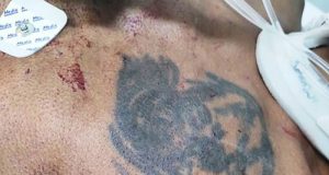 Ciclista que sofreu acidente na Expressa acaba morrendo na Santa Casa