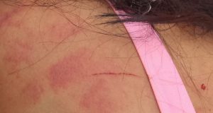 Após ser agredida pelo companheiro, mulher pede socorro em grupo do WhatsApp