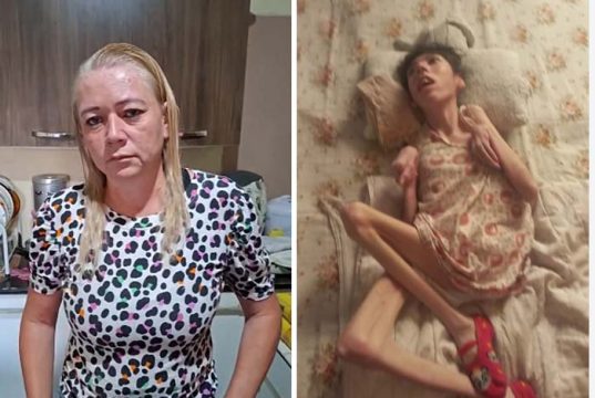 Thalyta é um ser humano que só quer comer e viver, independente do descaso da Saúde Pública
